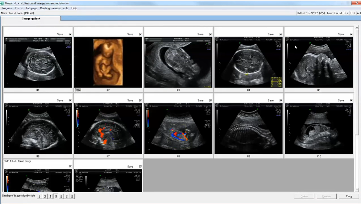 Mosos Ultrasound